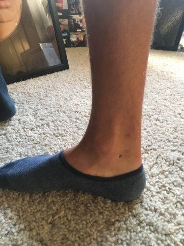 Katie's friend's lower leg with small black circle drawn below and to the rear of the ankle bone. The friend is wearing a blue no-show sock.
