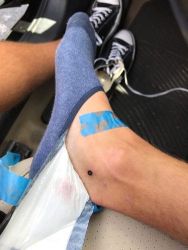 Mark's foot with a black circle just below the ankle bone. He's pulling back a bandage from the tattoo and wearing a no-show blue sock. A pair of black Keds can be seen in the background.